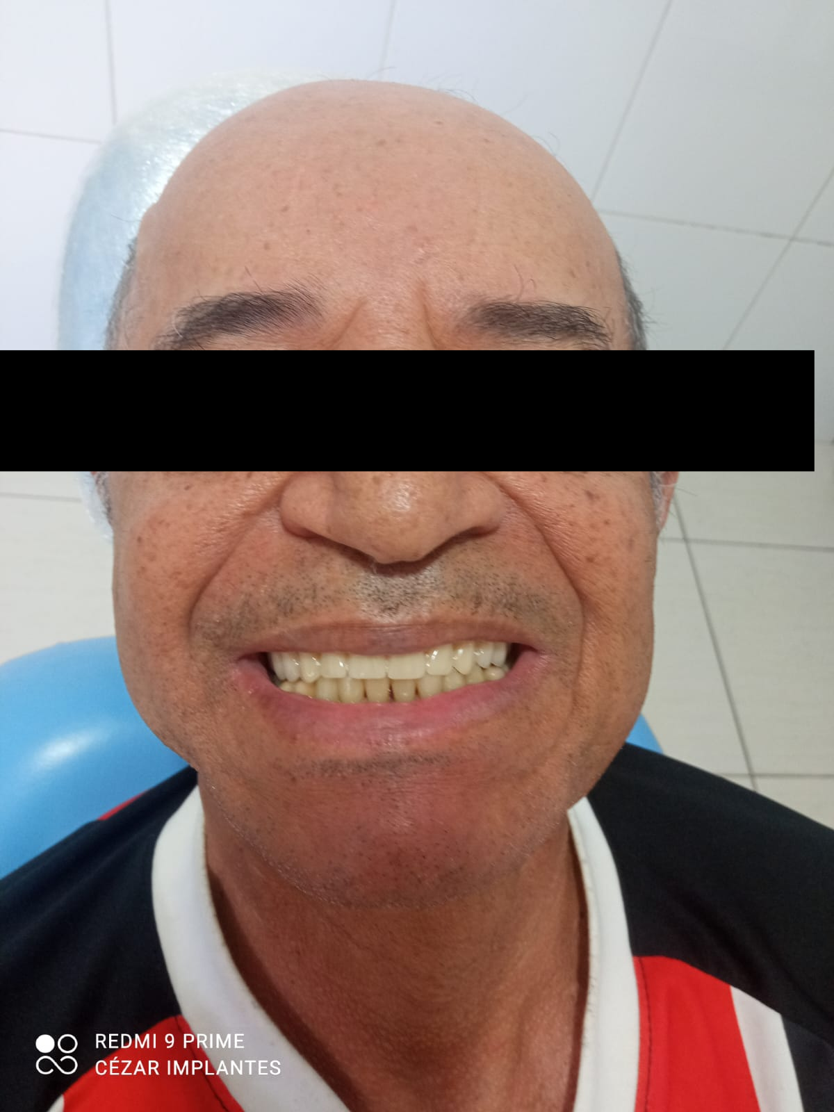 Depois do tratamento